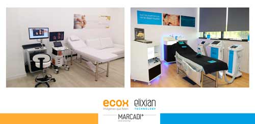Grupo Marcadi Salud, ECOX4D-5D Y ELIXIAN TECHNOLOGY seleccionan franquiciados en GALICIA